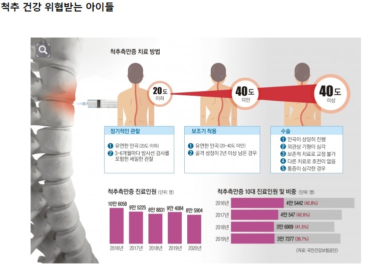 척추측만증 열 중 셋은 10대… 폐·심장기능 장애 동반 위험